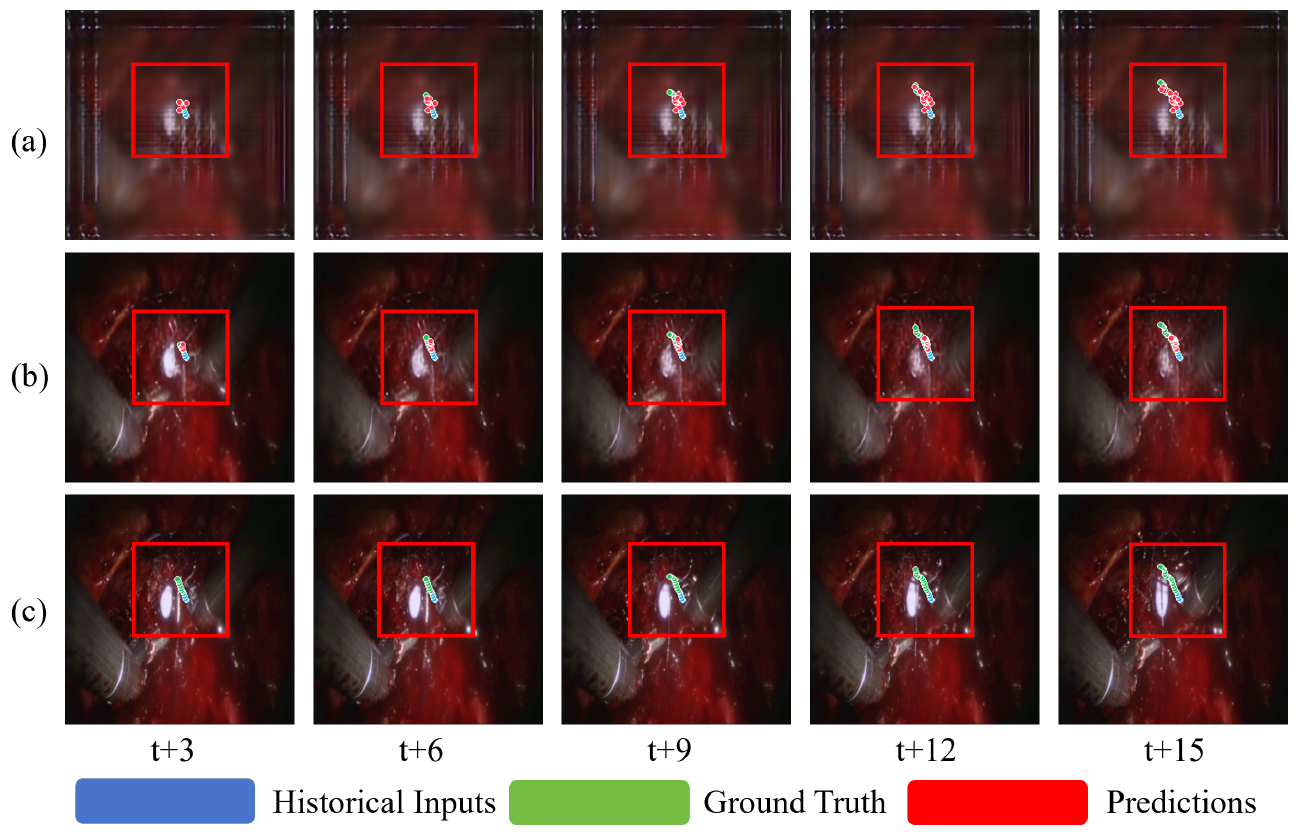 Three rows of surgical image crops at t+3, t+6, t+9, t+12 and t+15, with overlaid tool paths, red region boxes and the original blue/green/red trajectory legend.